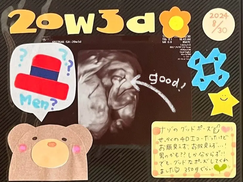 赤ちゃんがグッドサインするエコー写真